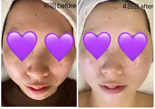 COCO beautyサロンのエステ・リラクイメージ