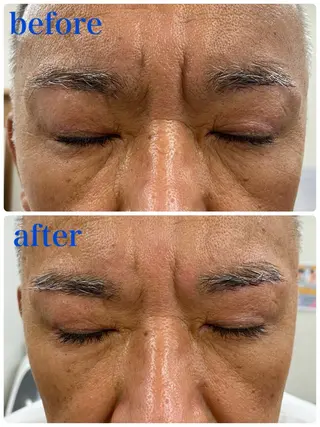 メンズ アイブロウ Mubye所属・Yamagtchi hinaのエステ・リラクイメージ