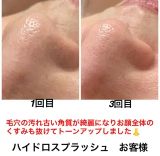 ネイル・エステサロン UILANIのネイルデザイン