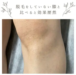 メンズ な ぎのエステ・リラクイメージ