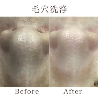 【毛穴洗浄・小顔】 セラピスト　和田紋子のエステ・リラクイメージ