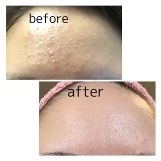 Belchic ベルシックのエステ・リラクイメージ