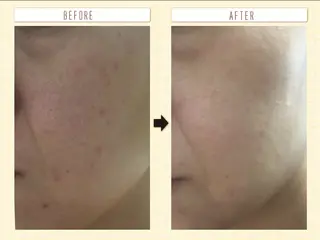 たるみ改善小顔エステ 堀葉月のその他イメージ