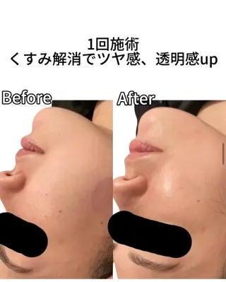 30min ノジマのエステ・リラクイメージ