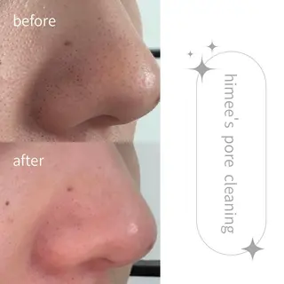 艶肌ハーブピーリング /毛穴洗浄のエステ・リラクイメージ