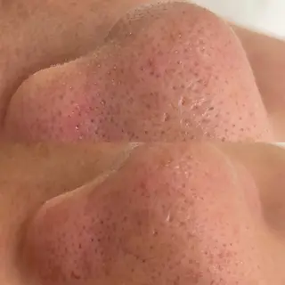 美肌育成専門サロンラクシュミー所属・毛穴肌管理サロン ラクシュミーのエステ・リラクイメージ