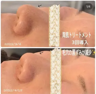 kana ハーブピーリング🌿のエステ・リラクイメージ