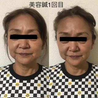 マッツンの 鍼のその他イメージ