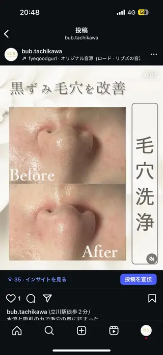 【BUB立川】 ななのエステ・リラクイメージ