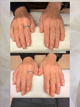 ネイル nailist Minaのネイルデザイン