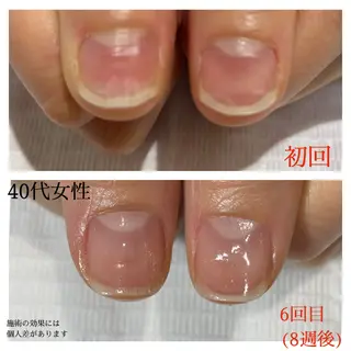 ネイル 自爪育成専門サロン エムロードゥ池下のネイルデザイン