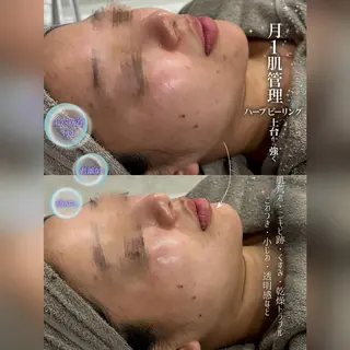 心斎橋🤍堀江.小顔 ハーブ.痩身クレビアのエステ・リラクイメージ