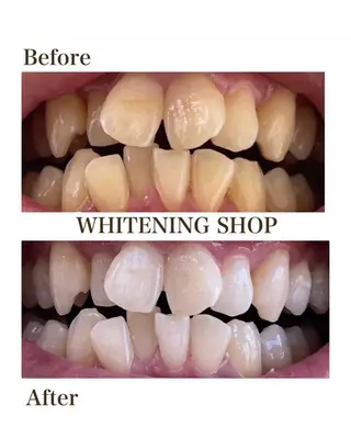 ホワイトニング ショップ津店のその他イメージ