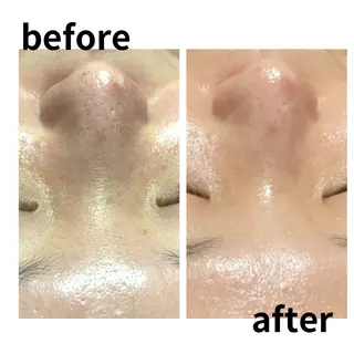 VIBLISS. ヴィブリスのネイルデザイン