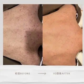 Life Salon別府店のエステ・リラクイメージ