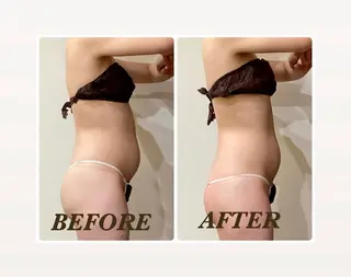 Prima 痩身脱毛 にごうかおりのエステ・リラクイメージ