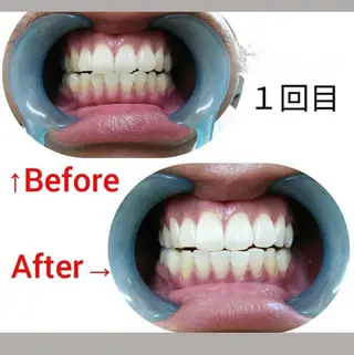 M渋谷 ホワイトニングのエステ・リラクイメージ