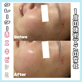 オールハンド専門🤍 痩身/小顔/ ハーブのエステ・リラクイメージ