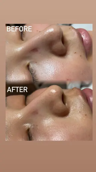 刀根 ひなたの眉毛・アイブロウイメージ