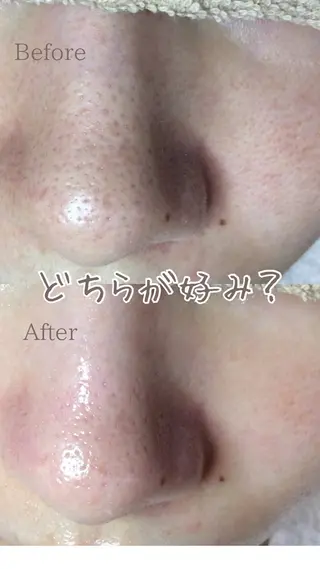 エステサロン Lazulisea所属・川口 春奈のエステ・リラクイメージ