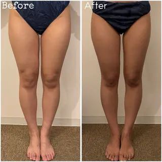 Tulipe Chihoのエステ・リラクイメージ