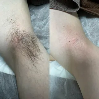 LULA大宮店 YOSHIWARAの眉毛・アイブロウイメージ