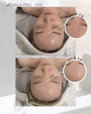 Soo Skin yunaのエステ・リラクイメージ