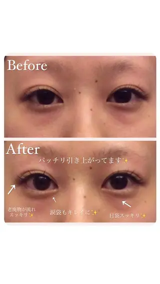 natura chuchuナトゥーラチュチュ所属・バスト体験 ナトゥーラチュチュのエステ・リラクイメージ