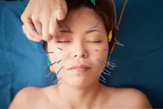 美楽鍼 びらくしんのその他イメージ