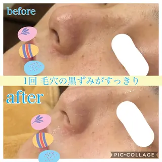 ロング カラー パーマ ヘアアレンジ キッズ ネイル マツエク・マツパ EnsorClair 代表 野口真央のエステ・リラクイメージ