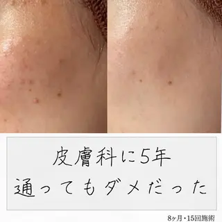 ニキビ経験者が施術 する専門サロン🌻のエステ・リラクイメージ