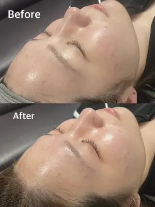 小顔専門看護師クリニカルサロンCOCO所属・小顔と美肌サロン クリニカルサロンココのエステ・リラクイメージ