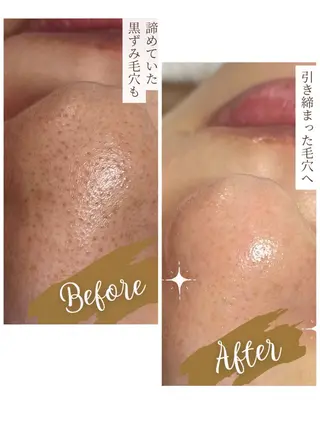 OUKA脱毛 毛穴ケアフェイシャルのエステ・リラクイメージ