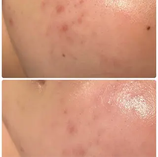 lumi riseのエステ・リラクイメージ