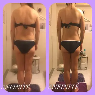 ANFINITÉ アンフィニテのエステ・リラクイメージ