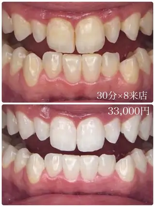 【歯科提携】柏ホワイ トニングスタイルのその他イメージ