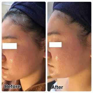 🌴Beauty Salon LANAのエステ・リラクイメージ