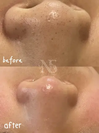 Nature Souce毛穴専門店のその他イメージ