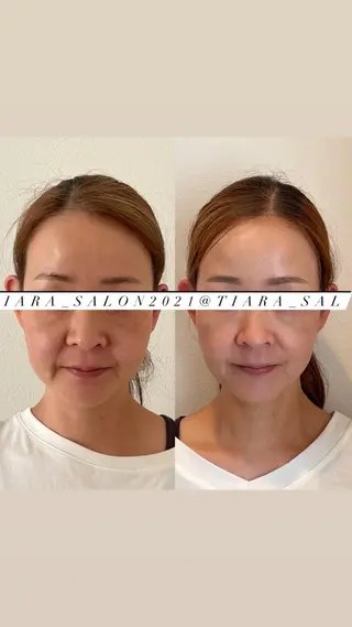 ロング カラー パーマ ヘアアレンジ メンズ キッズ ネイル マツエク・マツパ アイブロウ 鍼灸サロン TIARA　美容鍼のエステ・リラクイメージ