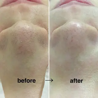 自宅サロン🏠 Nanalaのエステ・リラクイメージ