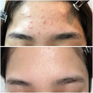 フェイシャルサロンLusis所属・肌質改善専門サロン Lusisのエステ・リラクイメージ