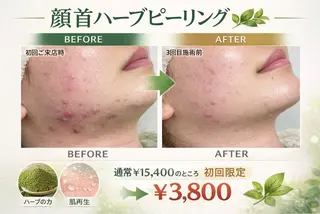 みんなの脱毛ツルリン ☀️船橋店☀️のエステ・リラクイメージ