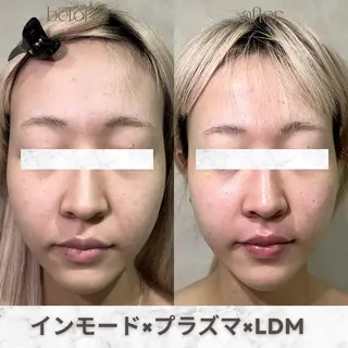 aimer 服部のその他イメージ