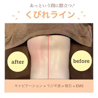 エステサロン JURISのエステ・リラクイメージ