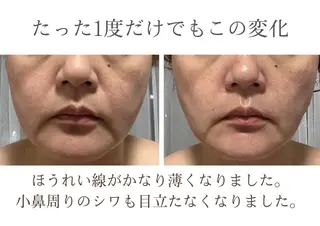 脂肪冷却/美肌改善 COCOKARAのエステ・リラクイメージ