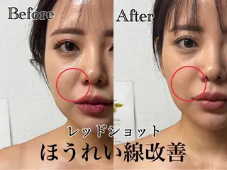 🌸🧡六本木 脱毛しずか🧡🫧の眉毛・アイブロウイメージ