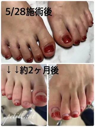 ネイル nail salon petillantのネイルデザイン