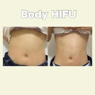 藤本 真心のネイルデザイン