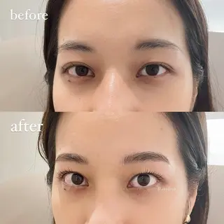 マツエク・マツパ 𝑹 eyelashのマツエク・マツパデザイン