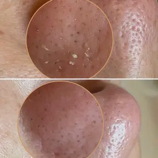 La cherieのエステ・リラクイメージ